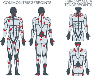 Chiropractic La Porte IN Trigger Points Chiropractic La Porte IN Trigger Points